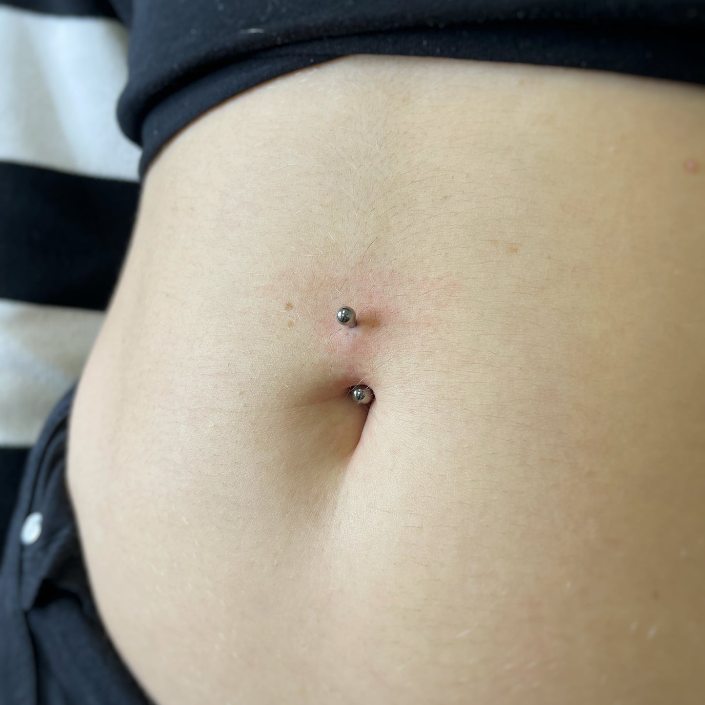 Banana per ombelico senza pietre